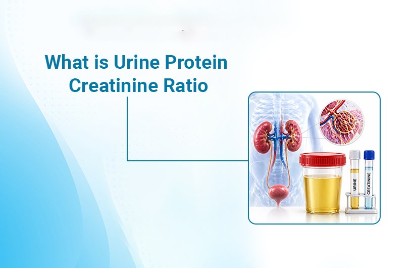 What is Urine Protein Creatinine Ratio