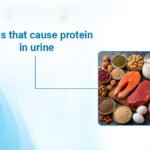 Foods That Cause Protein in Urine