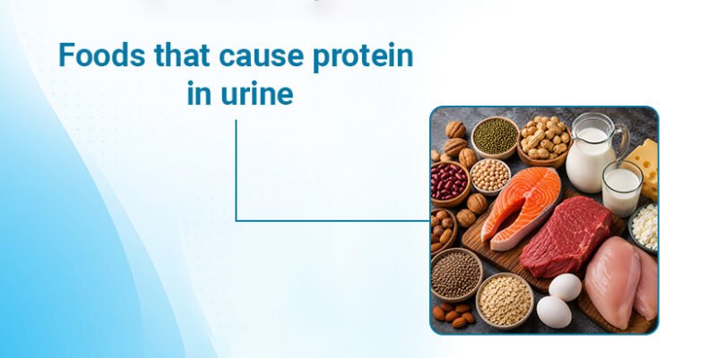 Foods That Cause Protein in Urine