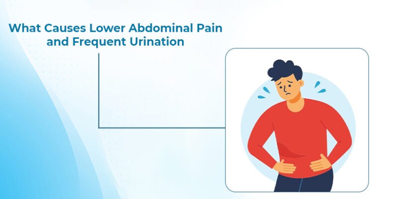 Lower Abdominal Pain and Frequent Urination