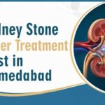 Kidney Stone Laser Treatment Cost in Ahmedaba