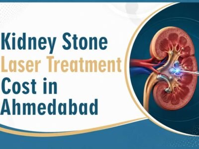 Kidney Stone Laser Treatment Cost in Ahmedabad