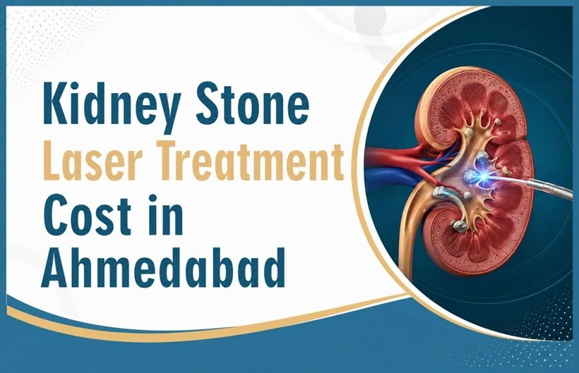 Kidney Stone Laser Treatment Cost in Ahmedaba
