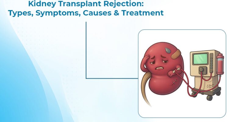 Kidney Transplant Rejection Treatment In Ahmedabad