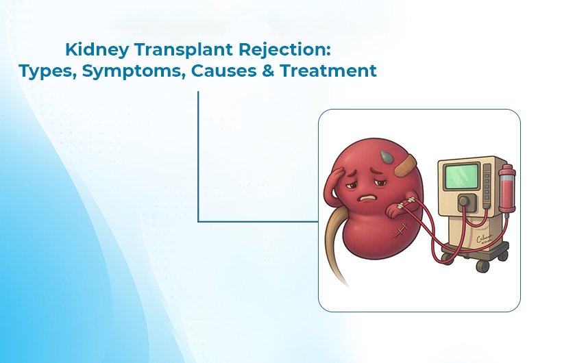 Kidney Transplant Rejection Treatment In Ahmedabad